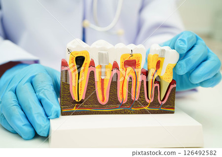 Dentist holding dental implant, artificial tooth roots into jaw, root canal of dental treatment, gum disease, teeth model for dentist. Dentist holding dental implant, artificial tooth roots into jaw, root canal of dental treatment, gum disease, teeth model for dentist. 126492582