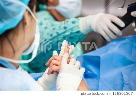 Female doctor performing a surgery. Orthopedic surgeon. Surgery and insurance concept. Hand surgery. Traumatology and orthopedics concept. Female doctor performing a surgery. Orthopedic surgeon. Surgery and insurance concept. Hand surgery. Traumatology and orthopedics concept. 126501567