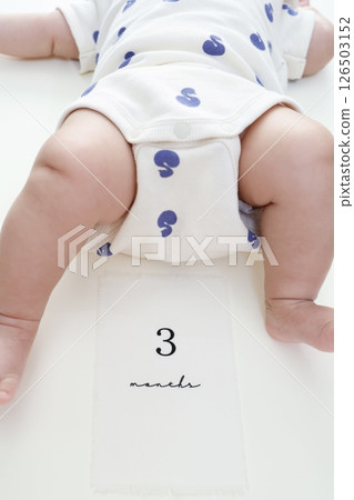 3 month old baby's enlarged legs 3 month old baby's enlarged legs 126503152