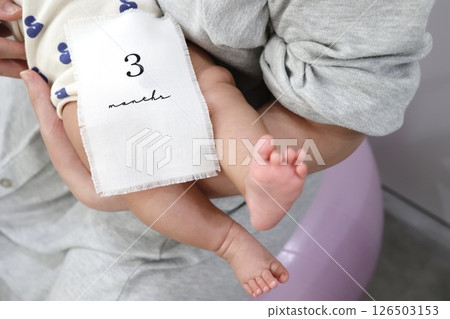 3 month old baby's enlarged legs 3 month old baby's enlarged legs 126503153