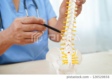 Asian doctor holding spinal nerve and bone model, Lumbar spine displaced herniated disc fragment for treatment medical in the orthopedic department. 126520658