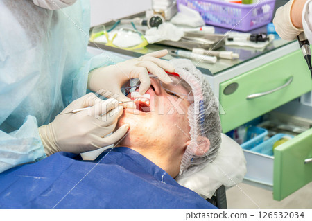 Dental cleaning procedure in a clinic with focus on plaque removal and teeth whiteness Dental cleaning procedure in a clinic with focus on plaque removal and teeth whiteness 126532034
