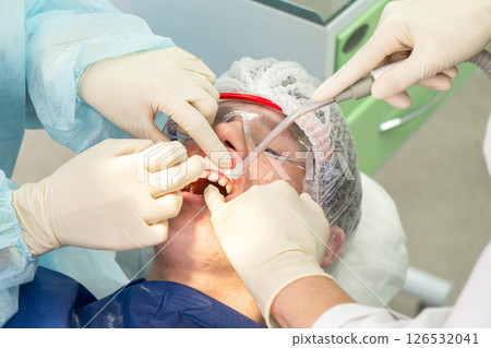 Dental cleaning procedure in a clinic with focus on plaque removal and teeth whiteness Dental cleaning procedure in a clinic with focus on plaque removal and teeth whiteness 126532041