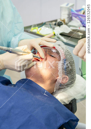 Dental cleaning procedure in a clinic with focus on plaque removal and teeth whiteness Dental cleaning procedure in a clinic with focus on plaque removal and teeth whiteness 126532045