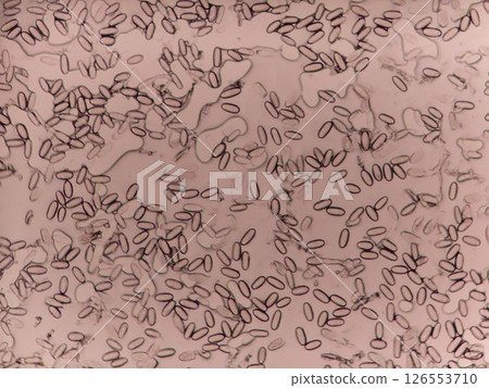 Mold spores that interfere with photosynthesis Mold spores that interfere with photosynthesis 126553710