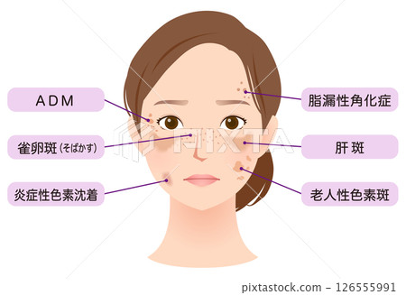 女人臉上有斑點，美麗，名字 126555991