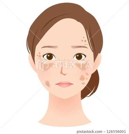 女人臉上有斑點，美麗，名字 126556001