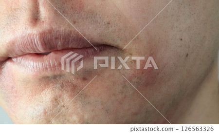A Japanese man whose beard has thinned due to hair removal 126563326
