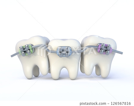 Cute cartoon style teeth with braces 3D Cute cartoon style teeth with braces 3D 126567816