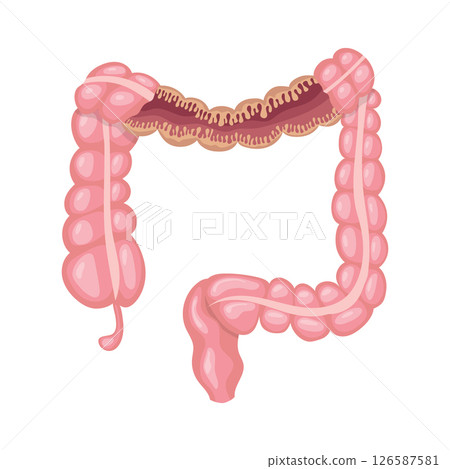 Large intestine showing its internal structure, including the appendix 126587581