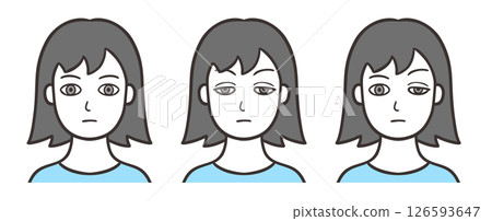 Woman's face with ptosis and normal condition 126593647