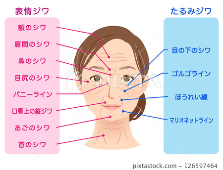 皺紋的類型 女性面部 美容 126597464