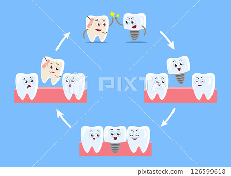 Dental implant procedure . Cartoon character illustration . Isolated on blue background . Vector . 126599618