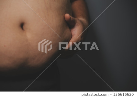 Asian fat man in front of a mirror looks at his body. Excess belly fat, Unhealthy lifestyle, Diet concept. 126616620
