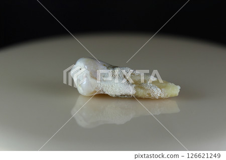 A sick, damaged human tooth. A sick, damaged human tooth. 126621249