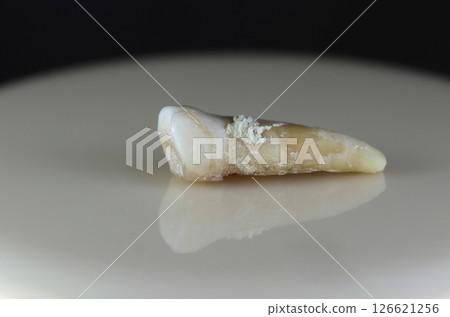 A sick, damaged human tooth. A sick, damaged human tooth. 126621256