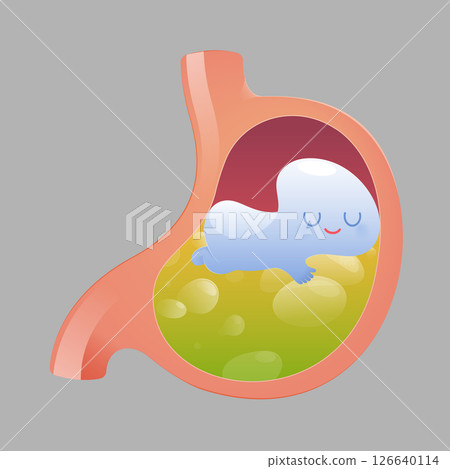 Cartoon image of liquid medicine easing acid reflux or reducing stomach acid. 126640114