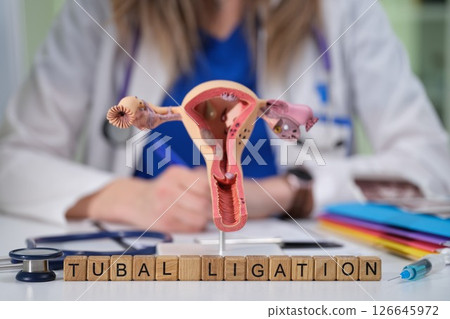 Understanding Tubal Ligation A Comprehensive Guide for Patients Seeking Information 126645972
