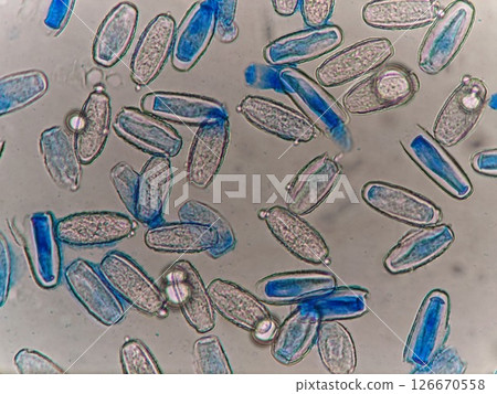 從甜豆葉中分離出的黴菌孢子 126670558