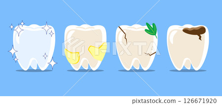 Healthy teeth, dental plaque, cracked tooth with food stuck, dental caries or tooth decayed . Set of flat design cartoon illustration . Isolated on Blue background . Vector . 126671920