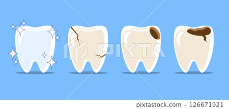 Healthy teeth, Cracked tooth, dental caries or tooth decayed . Set of flat design cartoon illustration . Isolated on Blue background . Vector . 126671921