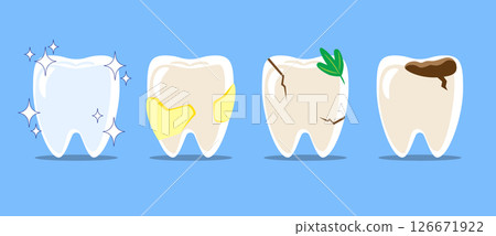 Healthy teeth, dental plaque, cracked tooth with food stuck, dental caries or tooth decayed . Set of flat design cartoon illustration . Isolated on Blue background . Vector . 126671922