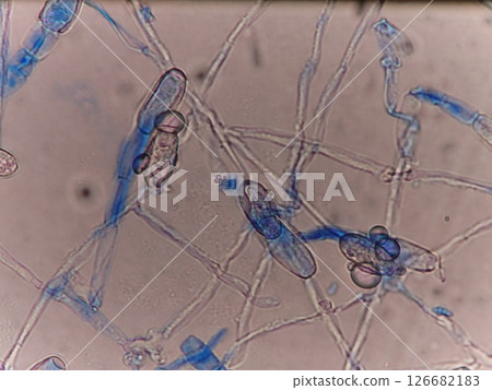 Fungal hyphae that cause problems on plant leaves 126682183