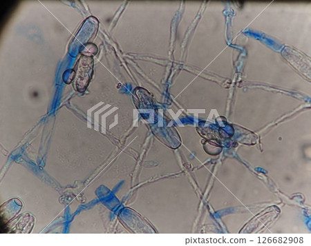 Mold spores growing from mycelium 126682908