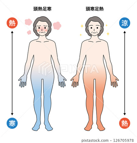Head cold foot heat Head cold foot heat 126705978