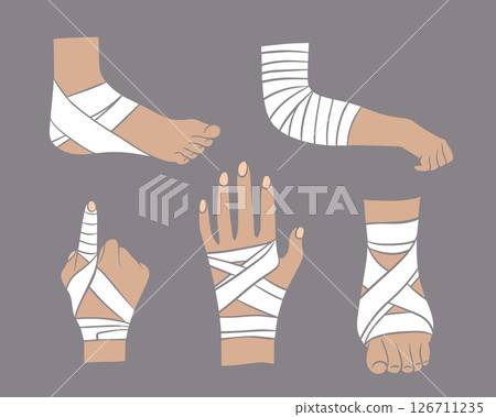 Vector isolated illustration of a set of bandaging of a leg and arm. First aid for limb sprains. Vector isolated illustration of a set of bandaging of a leg and arm. First aid for limb sprains. 126711235