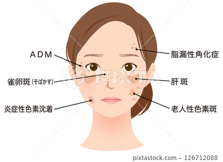 女人臉上有斑點，美麗，名字 126712088