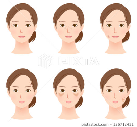 臉部斑點的類型 美容女性 126712431