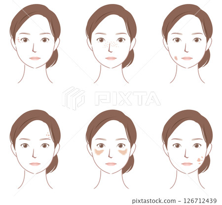 臉部斑點的類型 美容女性 126712439