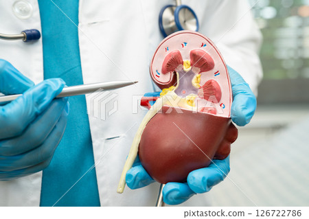 Kidney disease, Chronic kidney disease ckd, Doctor hold human model to treat and study in hospital. 126722786