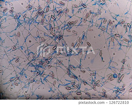 Powdery mildew spores spreading on the leaf surface 126722810