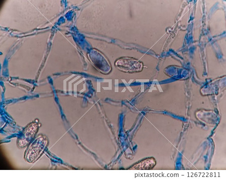 顯微鏡下觀察到的白粉病孢子 126722811