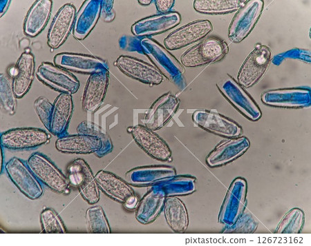 Common molds that occur on snap peas 126723162