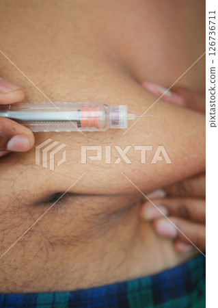 Patient inject insulin in the belly  126736711
