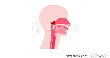 Enlarged adenoids poster Enlarged adenoids poster 126752838