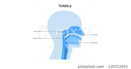 Tonsils anatomical poster Tonsils anatomical poster 126752841