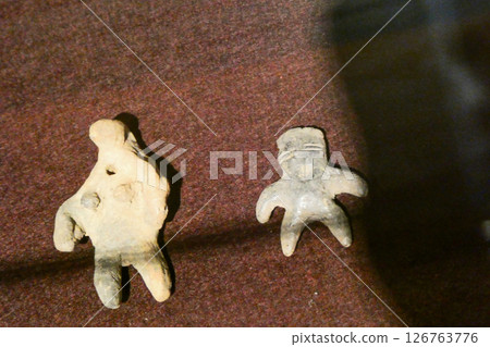 A pregnant woman called Jomon Boin has asphalt on her neck and right leg 126763776