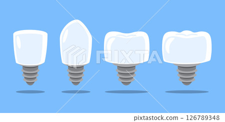 Dental implant . Type of teeth include incisor, canine, premolar and molar . Tooth cartoon illustration . Isolated on blue background . Flat design . Vector . 126789348