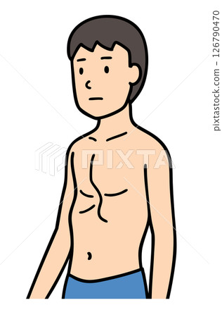男性漏斗胸、胸部畸形 126790470