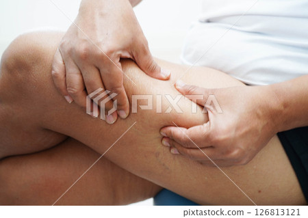 Asian woman with cellulite on leg skin fat, overweight problem. 126813121