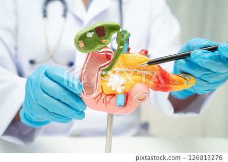 Liver with gallbladder, pancreas spleen and duodenum, Asian doctor holding human anatomy model for study diagnosis and treatment in hospital. 126813276