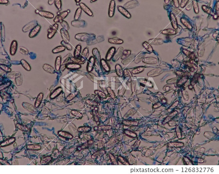 透過孢子傳播的白粉病 透過孢子傳播的白粉病 126832776