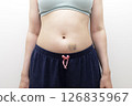 Closeup Human Abdominal Area And Hands With Hematoma, Bruise After Injection, Blood Sampling On White Background. Injury, Post-injection phlebitis. Horizontal plane. Trauma. 126835967