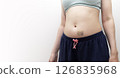 Female Person Belly And Hands With Hematoma, Bruise After Injection, Blood Sampling On White Background. Injury, Post-injection phlebitis. Copy Space For Text. Horizontal plane. Mockup 126835968