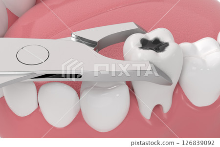 aching, damage, toothache 126839092
