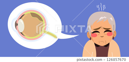 Senior Woman with Retinal Detachment Eye Problem Cartoon Vector Illustration Senior Woman with Retinal Detachment Eye Problem Cartoon Vector Illustration 126857670